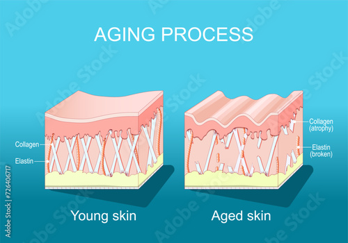 Aging process in the skin. wrinkles