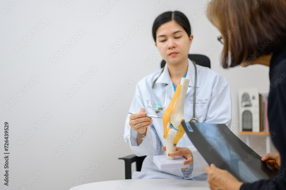 Asian female doctor shows knee bone model Explaining to a patient about the treatment of cruciate ligament injury in the knee medical treatment model. Asian female doctor shows knee bone model Explaining to a patient about the treatment of cruciate ligament injury in the knee medical treatment model.