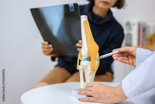 Orthopedic surgeon explains treatment of cruciate ligament injury to patient with knee bone model. photo