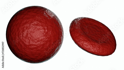 Tableau sur toile 3d rendering of spherocyte, it is a red blood cell (RBC) that is spherical in sh