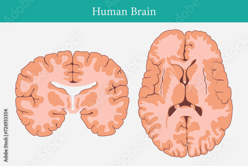Horizontal and vertical cross sections through cerebrum.  cross section of human brain. eps 10
