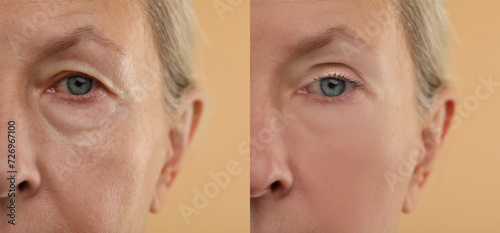 Aging skin changes. Woman showing face before and after rejuvenation, closeup. Collage comparing skin condition photo