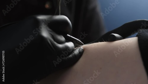 The process of removing unwanted hair using a device for electrolysis in a cosmetology office on a dark background. Close-up macro photography. photo