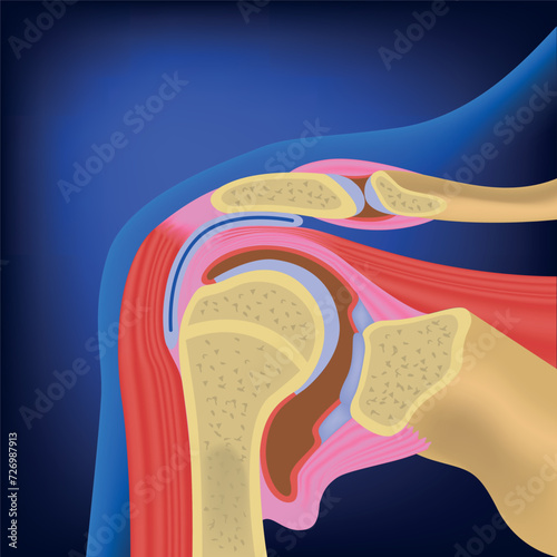 Anatomical structure of the shoulder joint and its muscles. Medical poster on a blue background. Vector illustration