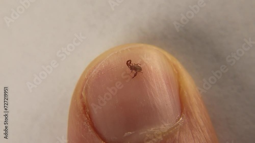 Pseudoscorpion.
False scorpion size comparison on the fingernail.
Biologist, Exotic vet holding a pseudo scorpion, wildlife veterinarian.
Arthropods, invertebrates.
bug, insect, animal, wild nature photo