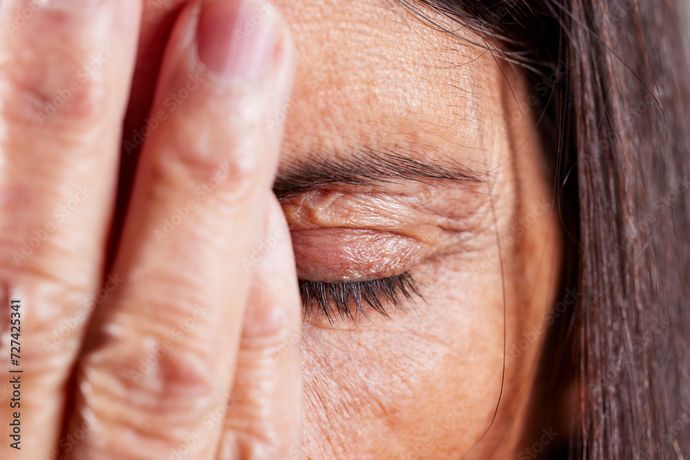 Close up of a mature woman with her hand covering her eyes Close up of a mature woman with her hand covering her eyes