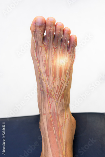 Orthopedic doctor or surgeon examined the patient with numbness of foot.Foot pain in Morton neuroma syndrome with transparent anatomy of nerve.Light effect on white background.Foot numbness and pain.
