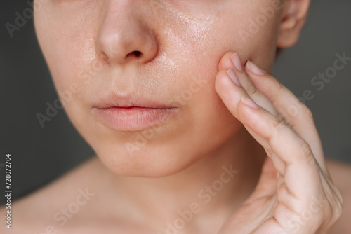 Cropped shot of a young caucasian woman with greasy skin touching the face with her hand isolated on a dark background. Cosmetology and beauty concept. Oily skin, shine on the face photo
