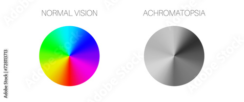 Achromatopsia vision deficiency