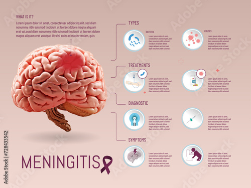 Infographics about Meninguitis, symptoms, treatments, types, brain image created with AI, on a solid color background, and icons added with illustrator.

