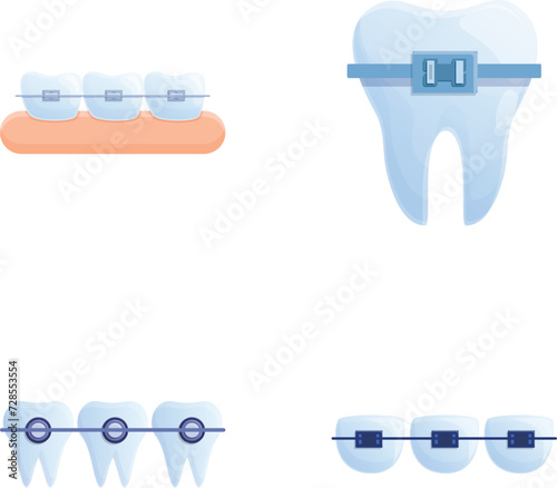 Teeth alignment icons set cartoon vector. Orthodontic brace system on teeth. Orthodontic treatment