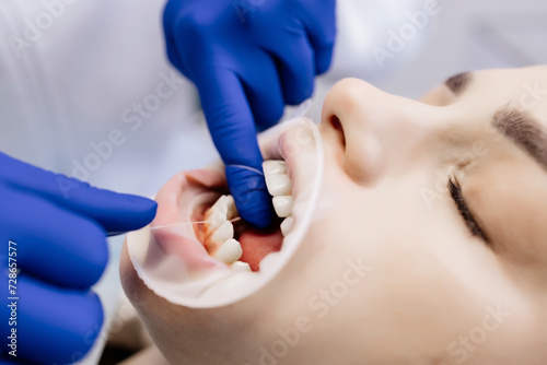 Close-up of flossing teeth. Dentistry, oral hygiene and dental treatment.
