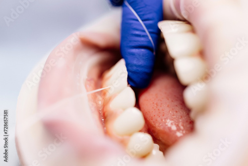 Close-up of flossing teeth. Dentistry  oral hygiene and dental treatment.