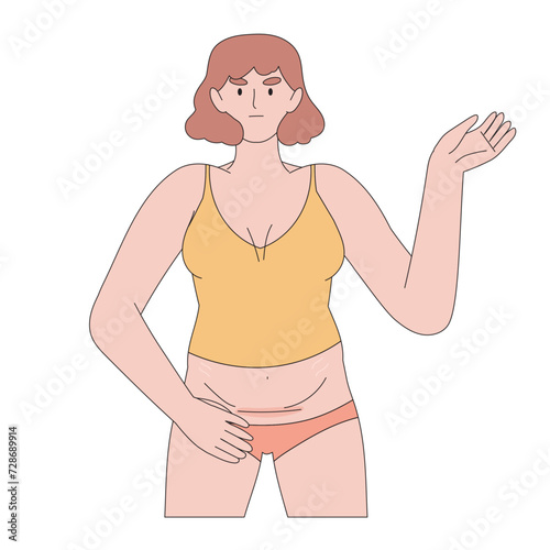Woman abdomen naked belly with cesarean scar recovery. C section surgery for pregnant woman. Recovering after birth. Caesarean scar after surgery because of baby birth hygiene and laser removal.
