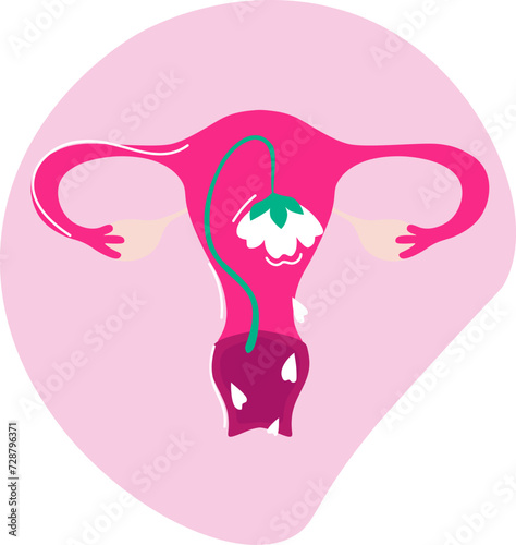 Thrush, also known as candidiasis or yeast infection, is a common fungal infection affecting women, characterized by discomfort, itching, and abnormal discharge in the genital area