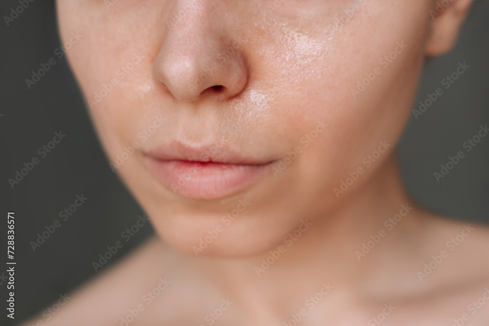 Cropped shot of a young caucasian woman with greasy skin on her skin on a dark background. Cosmetology and beauty concept. Oily skin, shine on the face - obrazy, fototapety, plakaty 