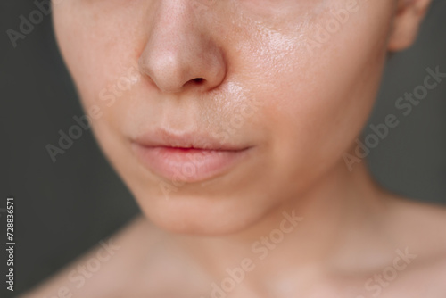Cropped shot of a young caucasian woman with greasy skin on her skin on a dark background. Cosmetology and beauty concept. Oily skin, shine on the face