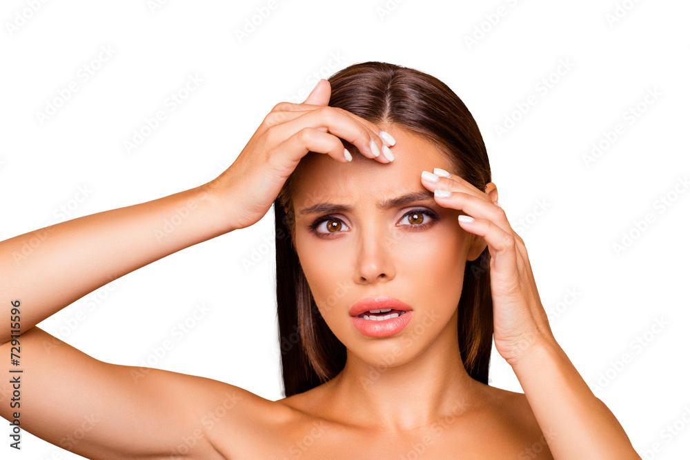 Scarred lady with naked shoulders she stand isolated on pastel beige background search acne on her face look at camera Scarred lady with naked shoulders she stand isolated on pastel beige background search acne on her face look at camera