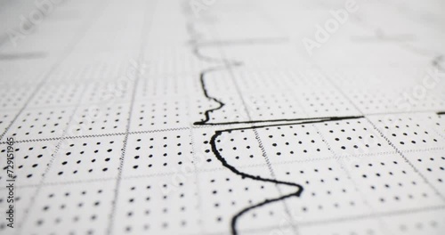 Printout of an ECG or EKG graph showing patient heart rate and electrical activity photo