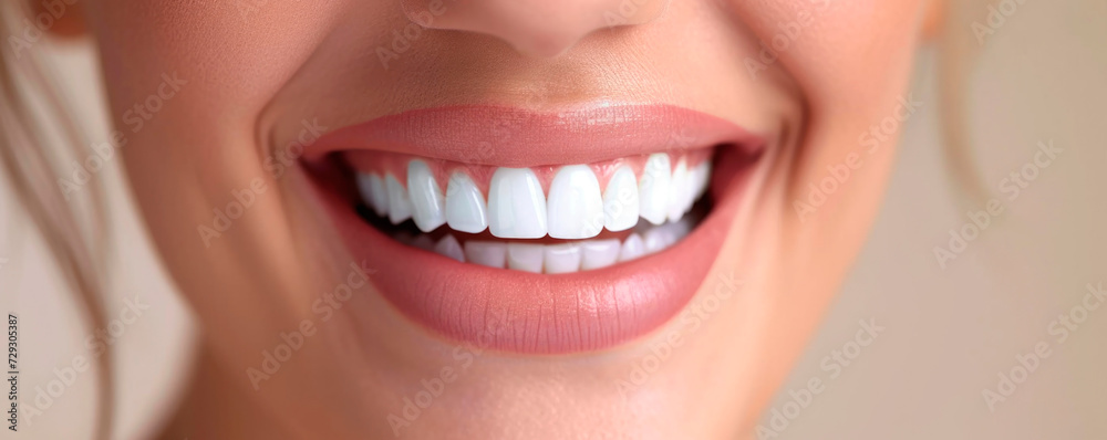 Beautiful female smile after teeth whitening procedure. Dental care. Dentistry concept.