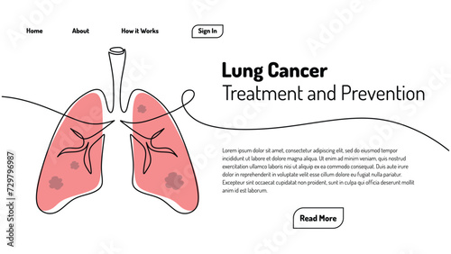 Lungs cancer continuous one line art drawing. Landing page web template. Vector human organ illustration healthcare medical concept.