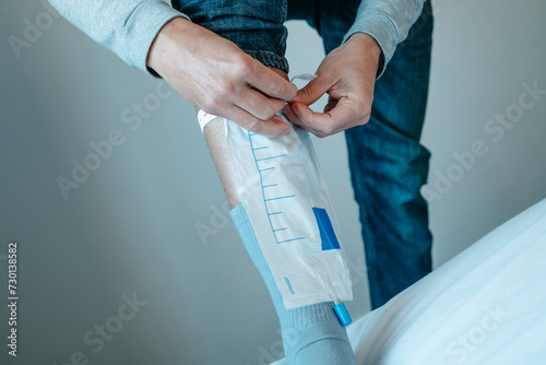 young man attaches his urine drainable leg bag photo