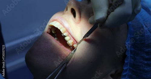 Face of patient, hands of stomatologist sutured wound after tooth extraction photo