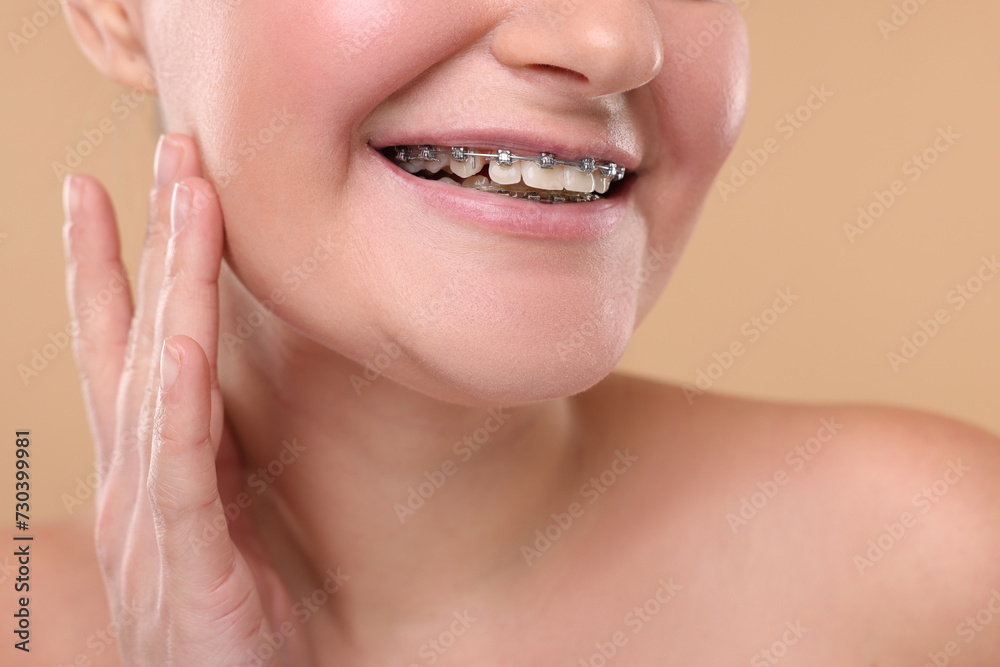 Obraz premium Smiling woman with dental braces on beige background, closeup