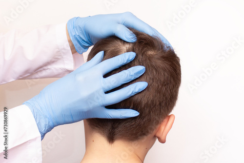 A doctor or pediatrician examines a child's head to check for lice and nits. Preventive examination of the scalp and hair of children in kindergarten, pediculosis. Problems related to itching. Health