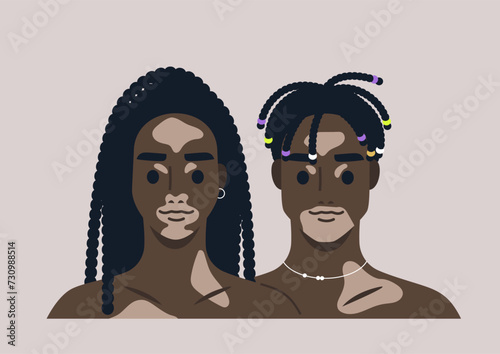 Digital illustration portraying two young African individuals with vitiligo set against a subtle backdrop, a long-term condition characterized by patches of the skin losing their pigment