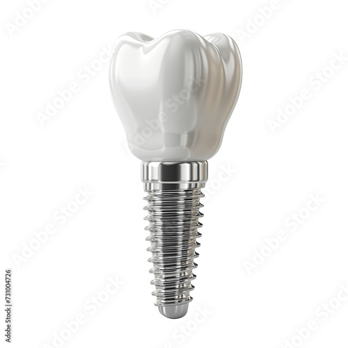 Dental implant isolated on transparent background. PNG