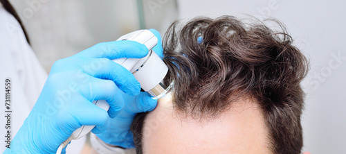 Close-up cosmetologist trichologist diagnoses the condition of the hair of a male patient with baldness using trichoscopy.