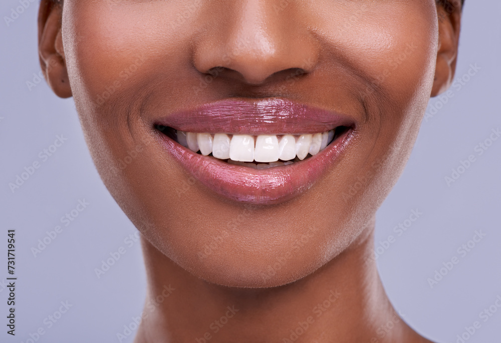Obraz premium Teeth whitening, dental and woman with beauty and health, oral hygiene and wellness with smile closeup on grey background. Mouth, lips and lipstick with orthodontics for veneers, cosmetics and skin