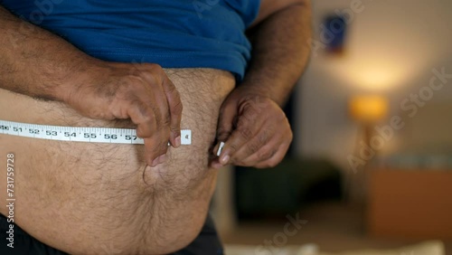 A fat man measures the size of the abdomen with a centimetre measuring tape - tummy measurement struggle  wide waist. A middle-aged man with a large belly - excess weight  unhealthy lifestyle  obes... photo