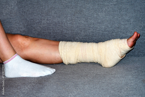  Woman with broken leg. female bandaging foot on the floor. The concept of a sore person with a limb injury. Close-up.