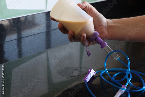 Woman holding the enteral nutrition bottle and infusion set in the kitchen. Enteral nutrition beeing prepared in the kitchen  photo
