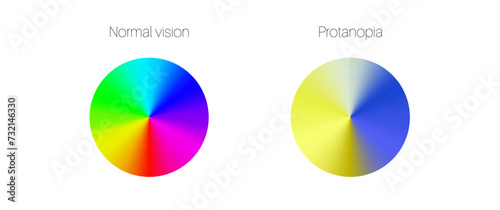 Protanomaly and protanopia