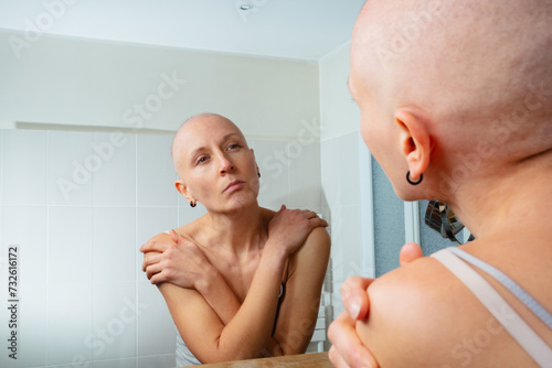Young woman confronting in mirror self-image with baldness
