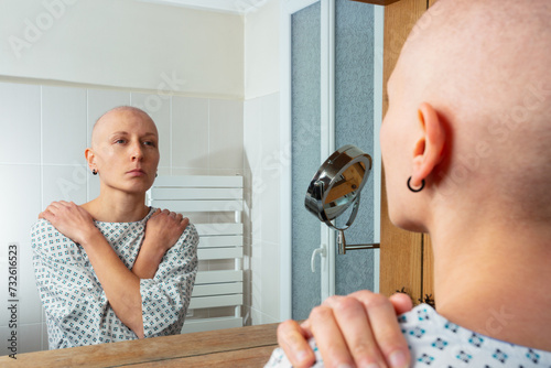 Bald woman at hospital facing the reality of baldness in mirror