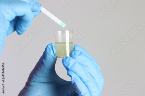 Foto Health care professional wearing gloves holding a cup with urine doing a glycemi