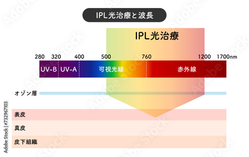 IPL光治療　アレキサンドライト　レーザー　波長　図　パルス幅