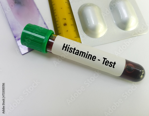 Blood sample for Histamine blood test, to diagnosis of anaphylaxis, mastocytosis, or mast cell activation. photo