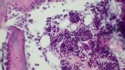Bild auf Leinwand Light microscopy of red bone marrow