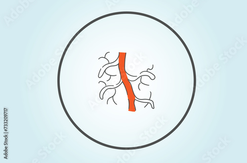 Varicose veins develop when the valves inside the veins weaken or become damaged, causing blood to pool and the veins to swell