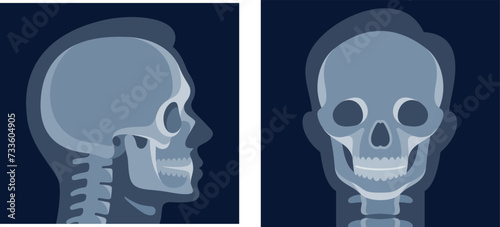 Human head x ray image skull front side view patient medical roentgen vector flat