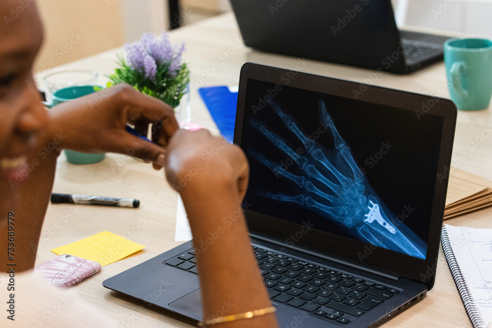 Doctor checks xray of the hand patient in office room. Doctor