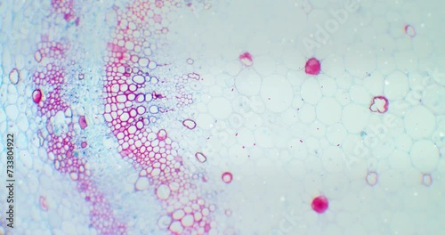 Cotton stem under a microscope with a focus on germs, microbes and bacteria. Infected view. Microscopic view of plant cells for botanic education. Cotton under a scope. Microscopic plant stem