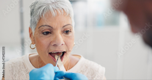 Patient, doctor and tongue depressor for throat assessment in clinic for respiratory infection, inflammation or wellness. Elderly woman, man and mirror for healthcare consultation, diagnosis or exam