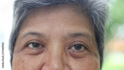 Close up elderly woman blinks her eyes at the camera : Elderly asians who do not wear eyeglasses have problems seeing astigmatism farsightedness and nearsightedness waiting for treatment. photo