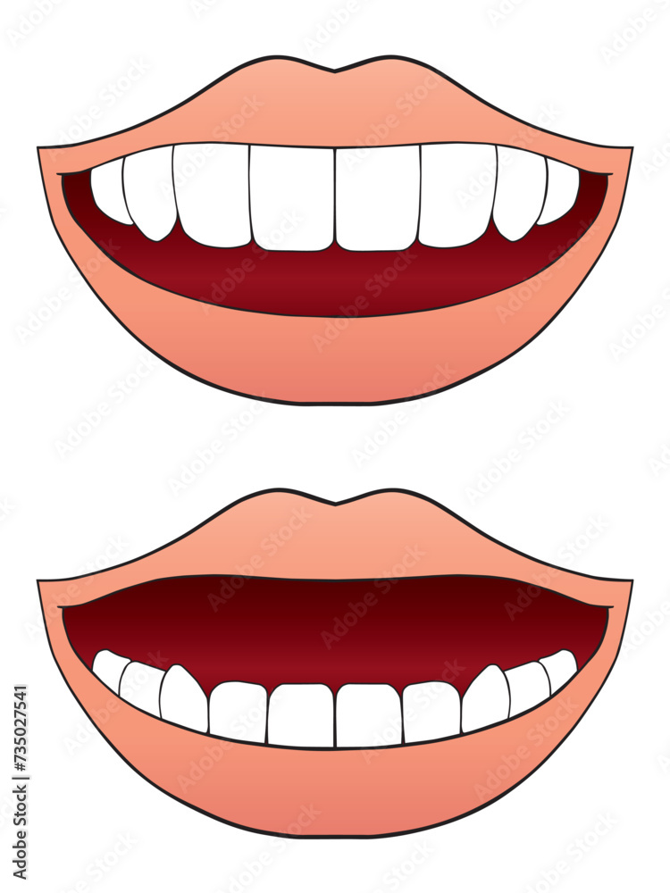 Fototapeta premium Upper and Lower Teeth Missing